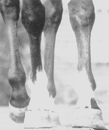 Mediolateral balance