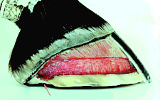 Loss of vertical depth